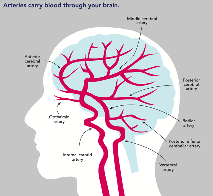 anterior cerebral artery stroke case study
